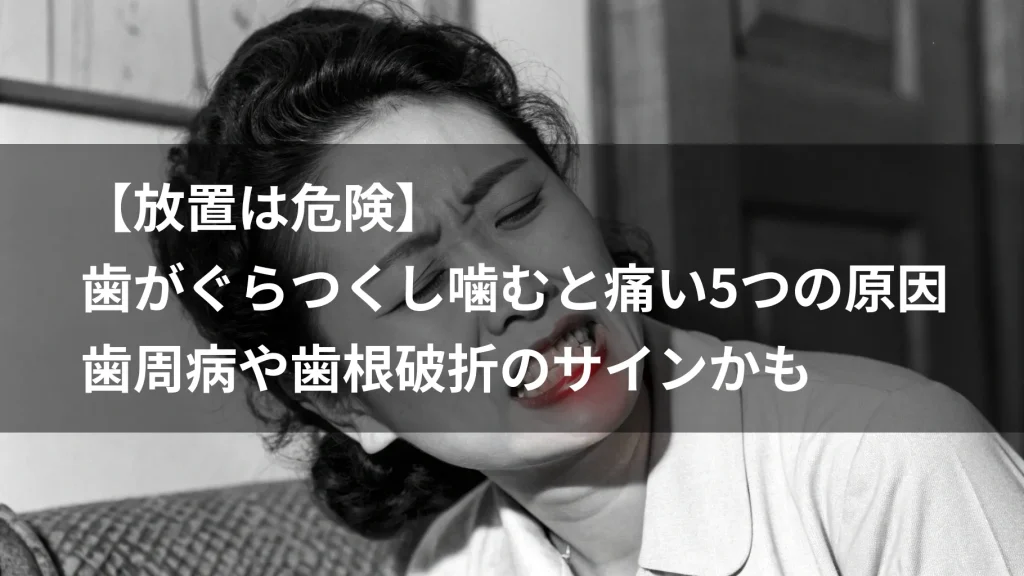 【放置は危険】歯がぐらつくし噛むと痛い5つの原因｜歯周病や歯根破折のサインかも